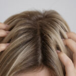 treatment of dandruff